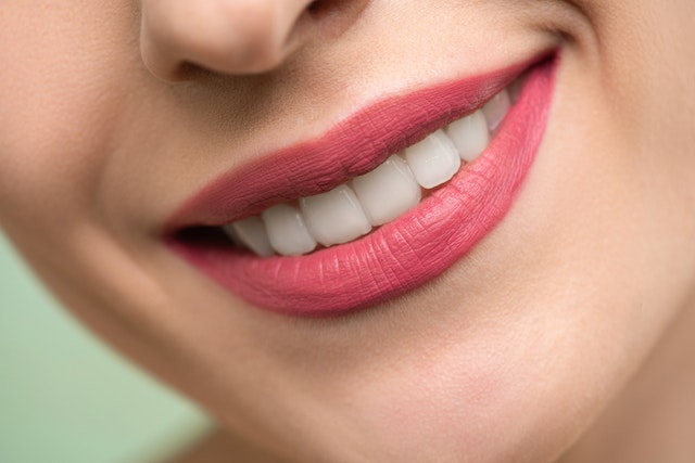 Przyciągaj białym uśmiechem – wybielanie zębów – Kraków 