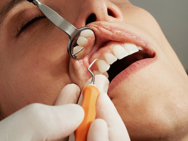 Implanty zębów Kraków opinie